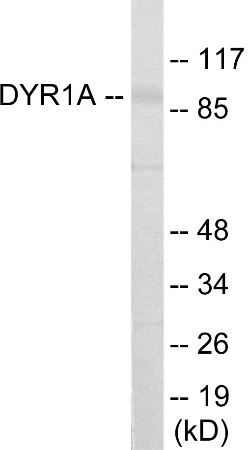 DYR1A Cell Based ELISA Kit (A103164-96)