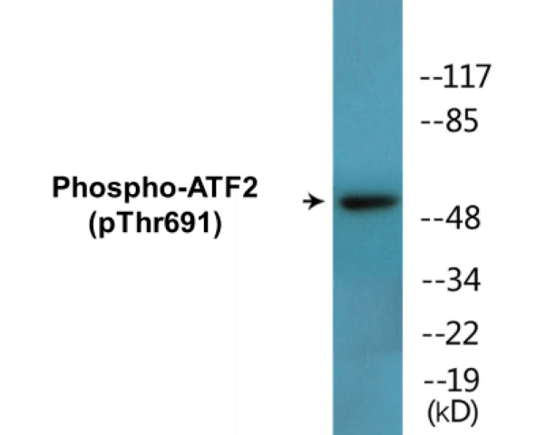 ATF2 (phospho Thr691) Cell Based ELISA Kit (A102325-296)