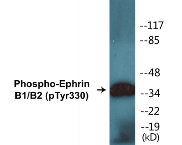 Ephrin B1 + B2 (phospho Tyr330) Cell Based ELISA Kit (A102374-296)