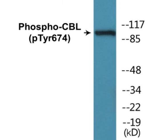 CBL (phospho Tyr674) Cell Based ELISA Kit (A102392-296)