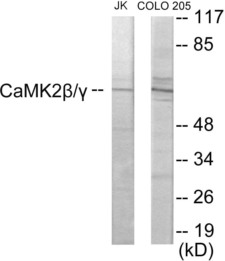 CaMK2 beta + gamma Cell Based ELISA Kit (A102815-96)