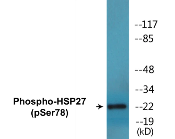 HSP27 (phospho Ser78) Cell Based ELISA Kit (A102744-296)