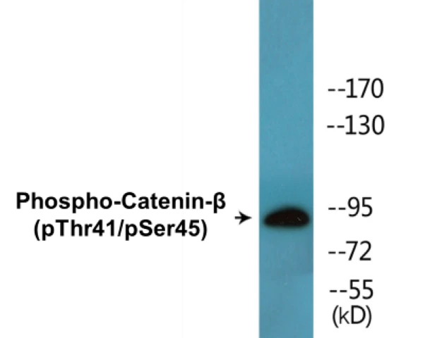 beta Catenin (phospho Thr41 + Ser45) Cell Based ELISA Kit (A102462-296)