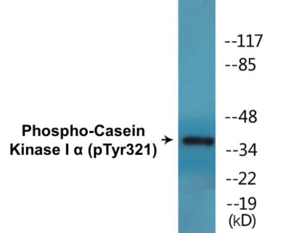 Casein Kinase I alpha (phospho Tyr321) Cell Based ELISA Kit (A102368-296)