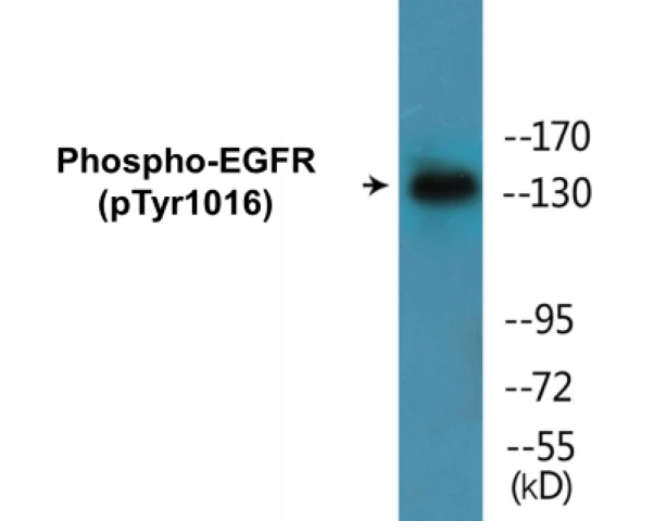 EGFR (phospho Tyr1016) Cell Based ELISA Kit (A102169-296)