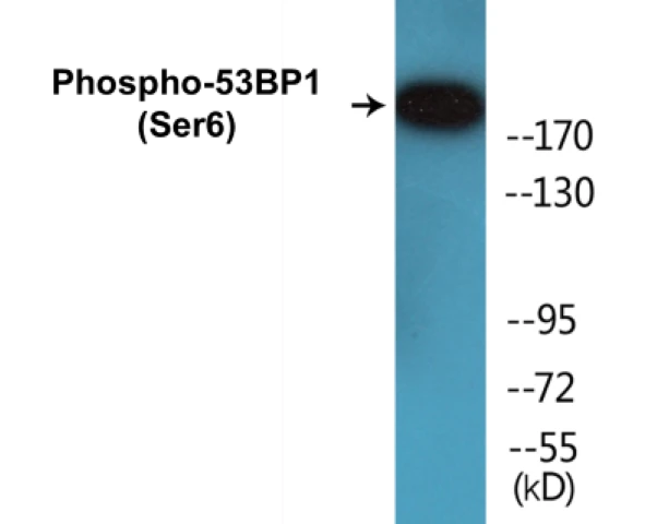 53BP1 (phospho Ser6) Cell Based ELISA Kit (A102385-296)