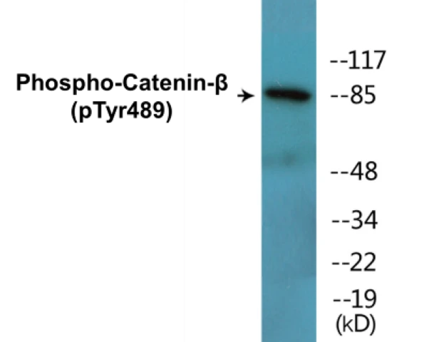 beta Catenin (phospho Tyr489) Cell Based ELISA Kit (A102484-296)