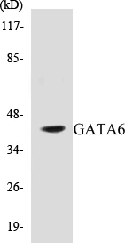 GATA6 Cell Based ELISA Kit (A103096-96)