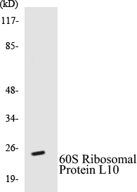 60S Ribosomal Protein L10 Cell Based ELISA Kit (A102835-96)