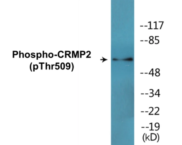 CRMP2 (phospho Thr509) Cell Based ELISA Kit (A102218-296)