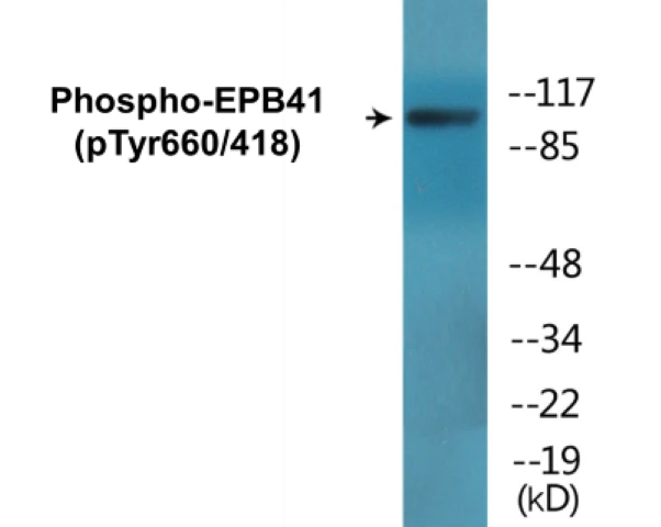 EPB41 (phospho Tyr660 + Tyr418) Cell Based ELISA Kit (A102660-296)