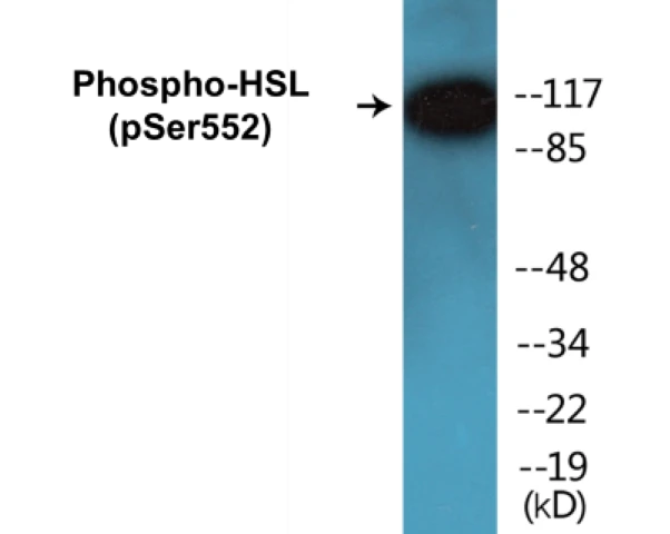 HSL (phospho Ser552) Cell Based ELISA Kit (A102387-296)