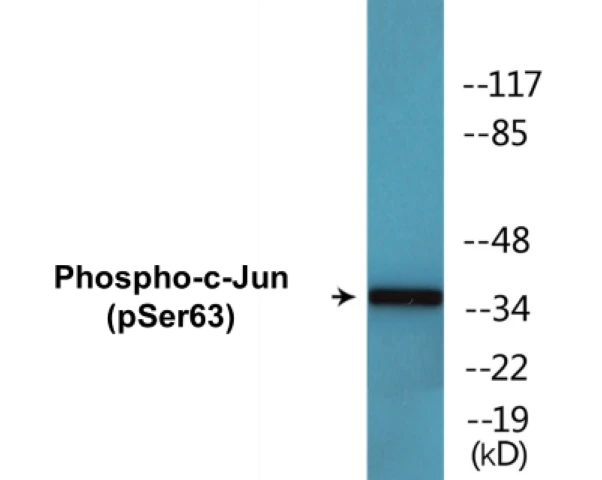 c-Jun (phospho Ser63) Cell Based ELISA Kit (A102328-296)