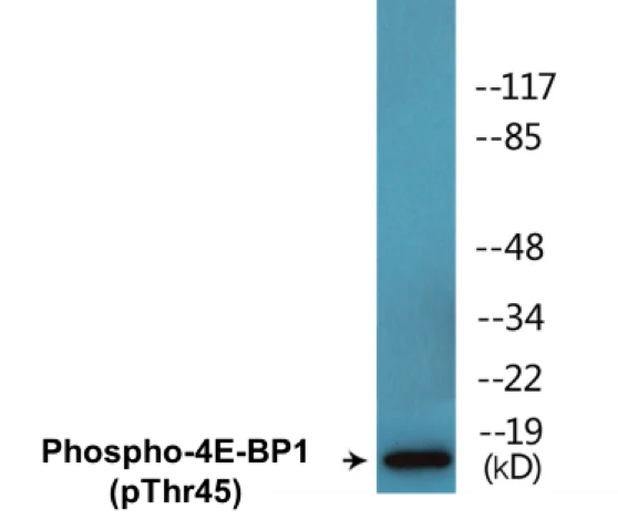 4E-BP1 (phospho Thr45) Cell Based ELISA Kit (A102193-296)