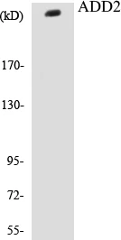 ADD2 Cell Based ELISA Kit (A103212-96)