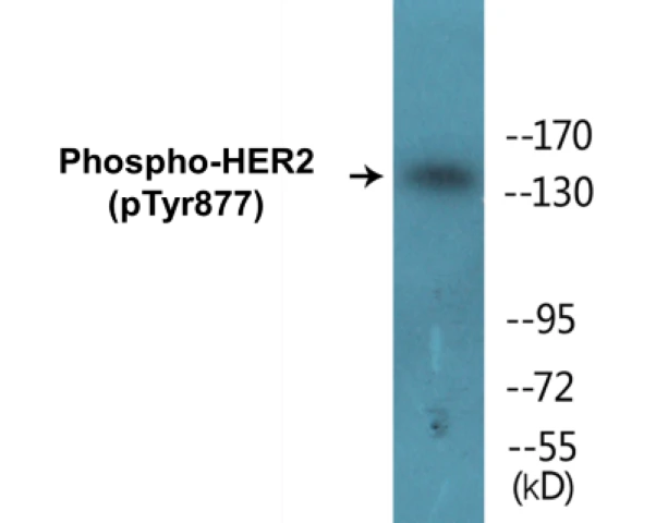 HER2 (phospho Tyr877) Cell Based ELISA Kit (A102334-296)