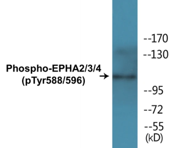 EPHA2 + 3 + 4 (phospho Tyr588 + Tyr596) Cell Based ELISA Kit (A102114-296)