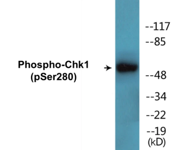 Chk1 (phospho Ser280) Cell Based ELISA Kit (A102741-296)