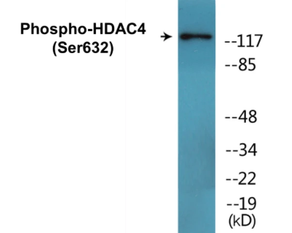 HDAC4 (phospho Ser632) Cell Based ELISA Kit (A102204-296)