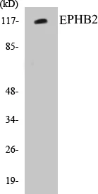 EPHB2 Cell Based ELISA Kit (A103678-96)