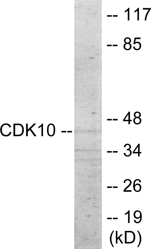 CDK10 Cell Based ELISA Kit (A103166-96)