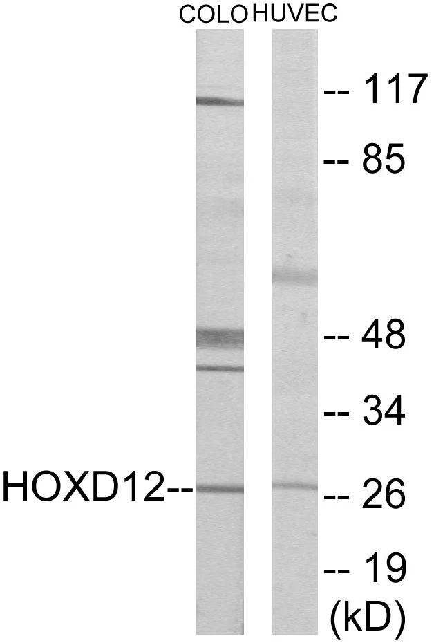 HOXD12 Cell Based ELISA Kit (A103418-96)