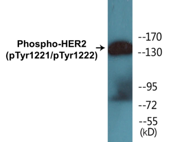 HER2 (phospho Tyr1221 + Tyr1222) Cell Based ELISA Kit (A102234-296)