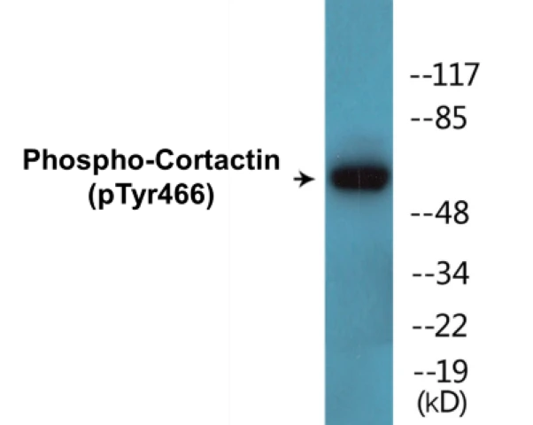 Cortactin (phospho Tyr466) Cell Based ELISA Kit (A102550-296)