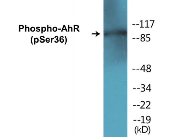 AhR (phospho Ser36) Cell Based ELISA Kit (A102472-296)