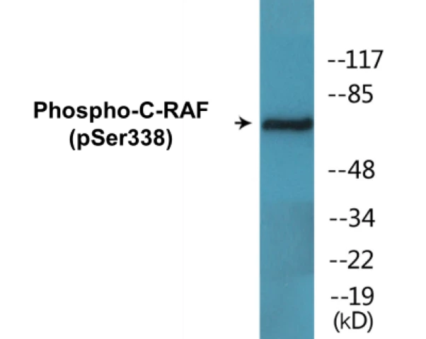 C-RAF (phospho Ser338) Cell Based ELISA Kit (A102210-296)