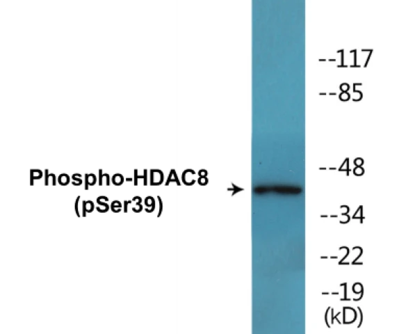 HDAC8 (phospho Ser39) Cell Based ELISA Kit (A102333-296)