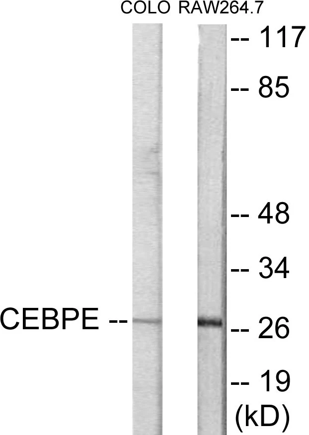 CEBPD + E Cell Based ELISA Kit (A102946-96)