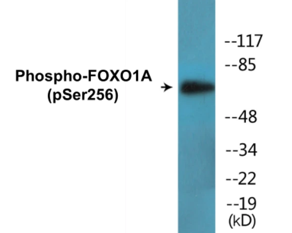 FOXO1A (phospho Ser256) Cell Based ELISA Kit (A102078-296)