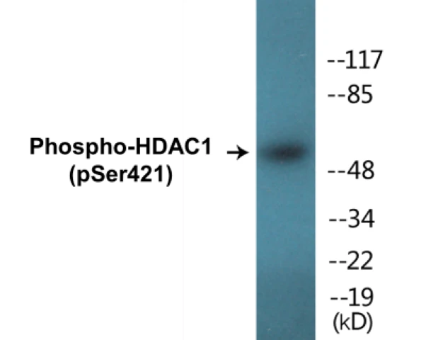 HDAC1 (phospho Ser421) Cell Based ELISA Kit (A102179-296)