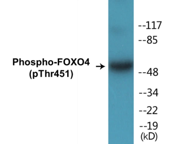 FOXO4 (phospho Thr451) Cell Based ELISA Kit (A102627-296)