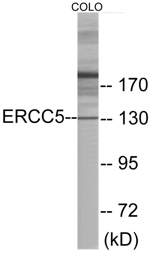 ERCC5 Cell Based ELISA Kit (A103693-96)