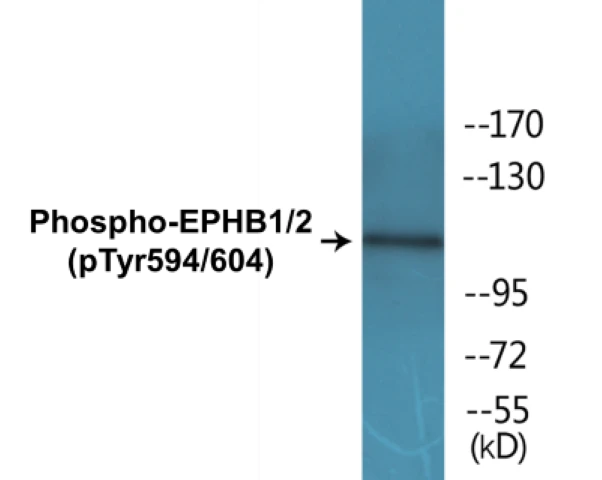 EPHB1 + 2 (phospho Tyr594 + Tyr604) Cell Based ELISA Kit (A102042-296)