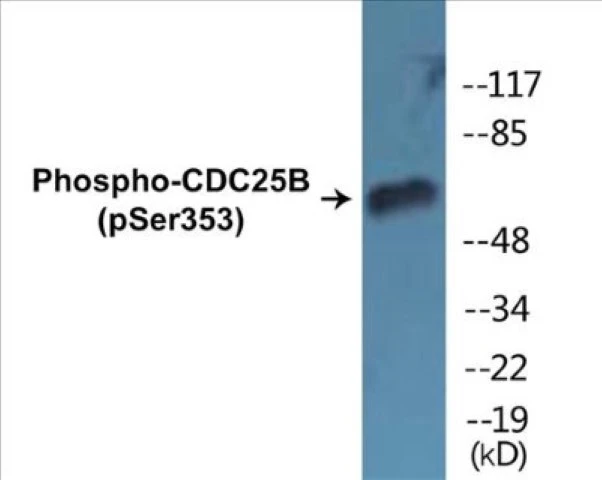 CDC25B (phospho Ser353) Cell Based ELISA Kit (A102708-296)