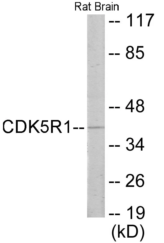 CDK5R1 Cell Based ELISA Kit (A102986-96)