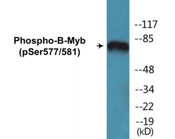 B-Myb (phospho Ser577 + Ser581) Cell Based ELISA Kit (A102375-296)