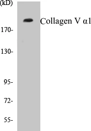 Collagen V alpha 1 Cell Based ELISA Kit (A103608-96)