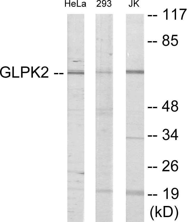 GK2 Cell Based ELISA Kit (A103756-96)