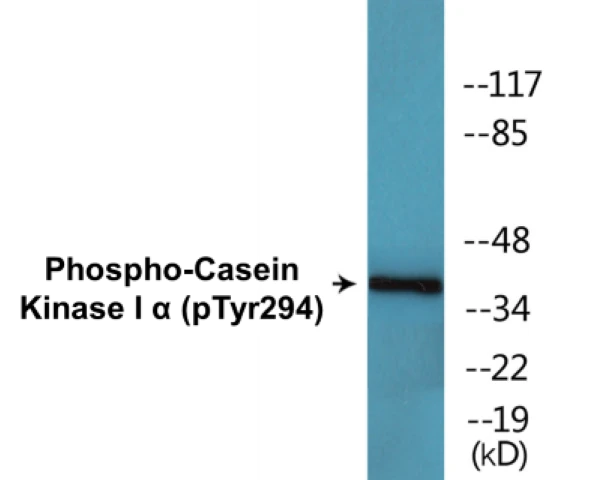 Casein Kinase I alpha (phospho Tyr294) Cell Based ELISA Kit (A102369-296)