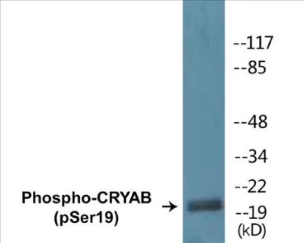 CRYAB (phospho Ser19) Cell Based ELISA Kit (A102312-296)