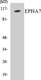 EPHA7 Cell Based ELISA Kit (A103089-96)