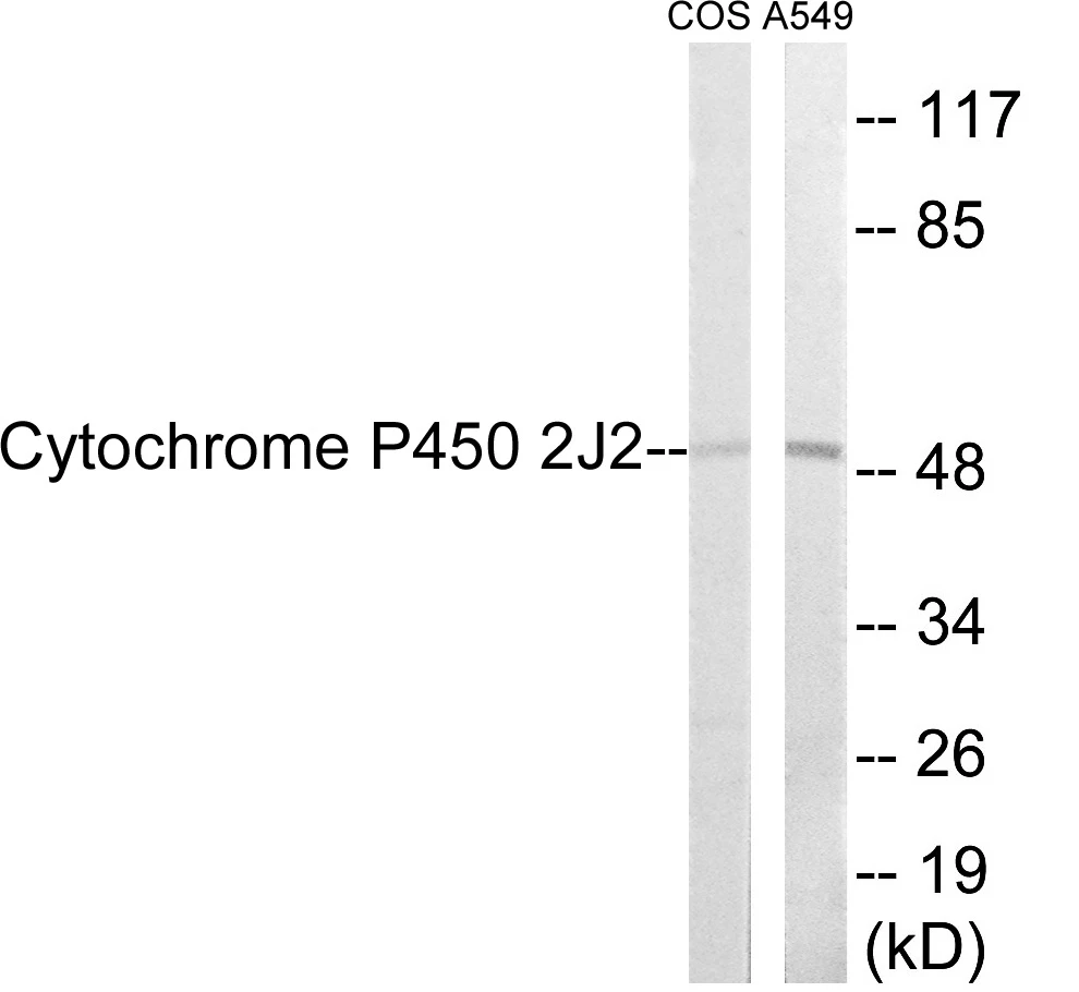 Cytochrome P45 02J2 Cell Based ELISA Kit (A103603-96)