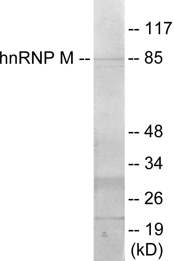 hnRNPM Cell Based ELISA Kit (A103022-96)