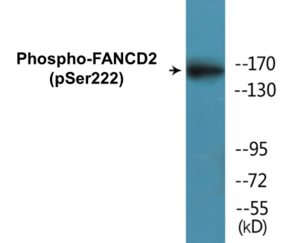 FANCD2 (phospho Ser222) Cell Based ELISA Kit (A102093-296)