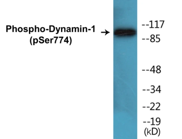 Dynamin-1 (phospho Ser774) Cell Based ELISA Kit (A102539-296)