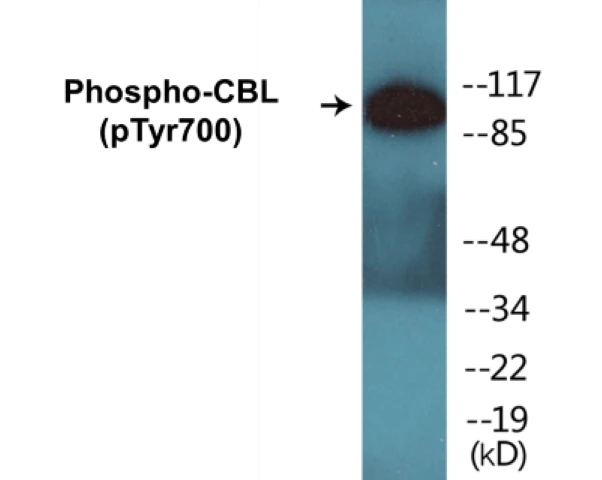 CBL (phospho Tyr700) Cell Based ELISA Kit (A102419-296)